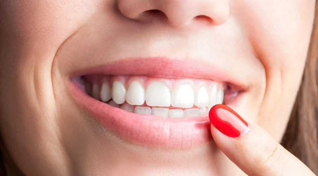 Après blanchiment dentaire : conseils du cabinet dentaire Mirabeau à Paris