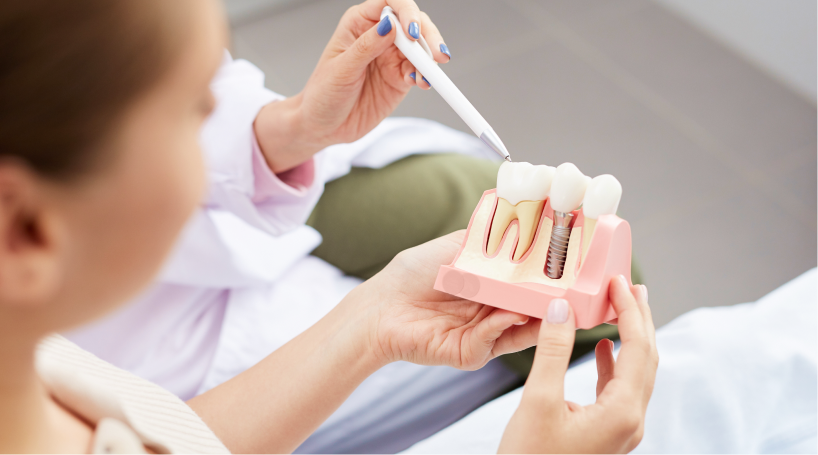 Pose des implants dentaires au cabinet Mirabeau Paris 75016